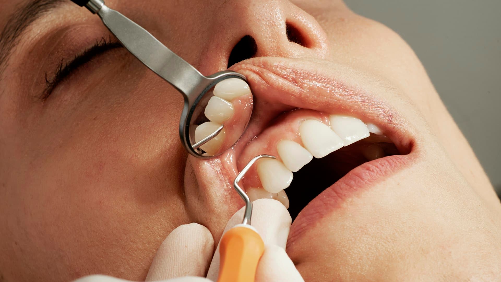 Pemeriksaan gigi dengan kaca mulut dan alat dental, menilai garis gusi pasien