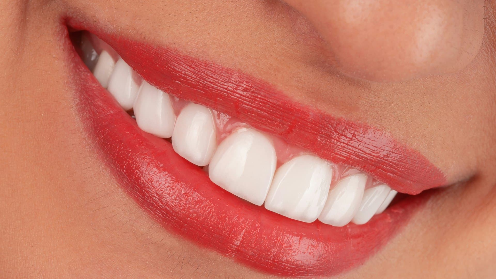 Close-up senyum perempuan dengan lipstik merah, memperlihatkan deretan gigi yang rapi alami